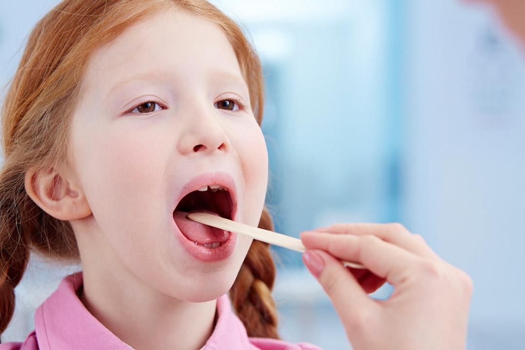 أطعمة تسبب التهاب الحلق